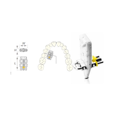 Винт расширяющий Vector 460, Scheu-Dental, Германия